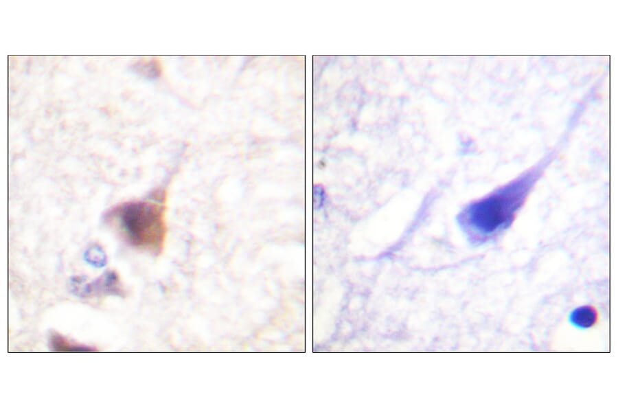 Immunohistochemistry - Anti-CaMK4 (phospho Thr196 + Thr200) Antibody (A0831) - Antibodies.com