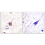 Immunohistochemistry - Anti-CaMK4 (phospho Thr196 + Thr200) Antibody (A0831) - Antibodies.com