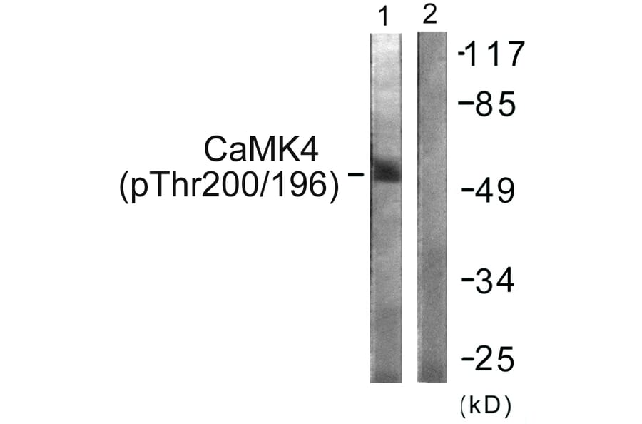 Western Blot - Anti-CaMK4 (phospho Thr196 + Thr200) Antibody (A0831) - Antibodies.com