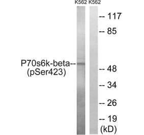 Western Blot - Anti-p70 S6 Kinase beta (phospho Ser423) Antibody (A8157) - Antibodies.com