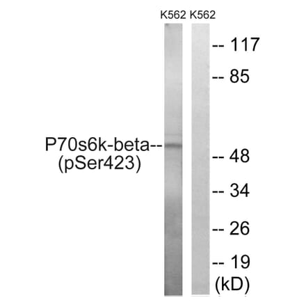 Western Blot - Anti-p70 S6 Kinase beta (phospho Ser423) Antibody (A8157) - Antibodies.com