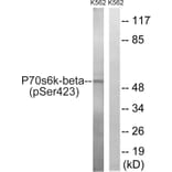 Western Blot - Anti-p70 S6 Kinase beta (phospho Ser423) Antibody (A8157) - Antibodies.com