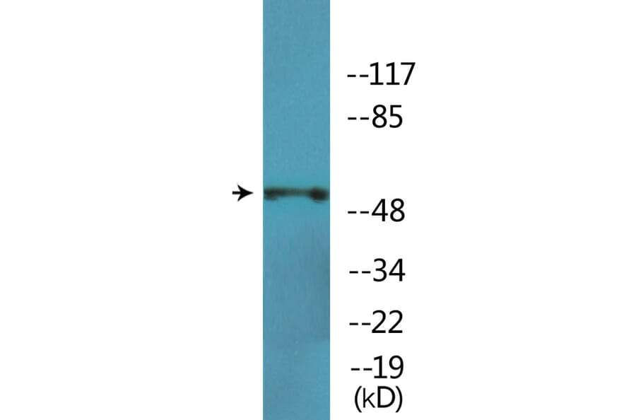 Western Blot - Anti-p70 S6 Kinase beta (phospho Ser423) Antibody (P12-1160) - Antibodies.com