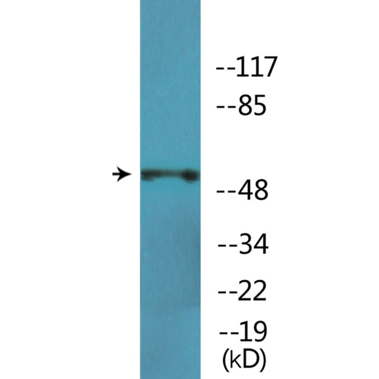 Western Blot - Anti-p70 S6 Kinase beta (phospho Ser423) Antibody (P12-1160) - Antibodies.com