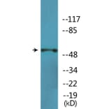 Western Blot - Anti-p70 S6 Kinase beta (phospho Ser423) Antibody (P12-1160) - Antibodies.com