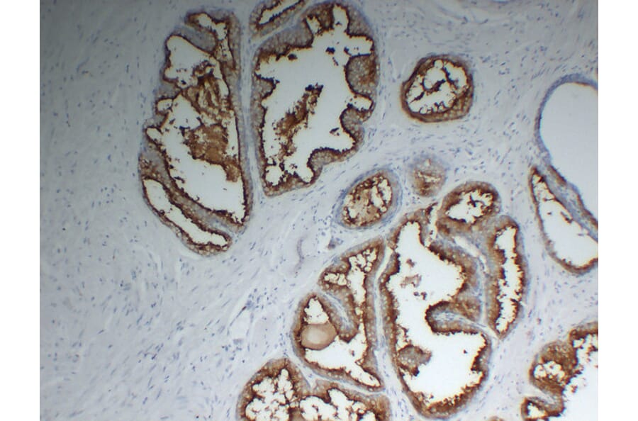 Immunohistochemistry - Anti-Prostate Specific Membrane Antigen Antibody (V0119) - Antibodies.com