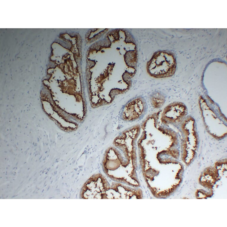 Immunohistochemistry - Anti-Prostate Specific Membrane Antigen Antibody (V0119) - Antibodies.com