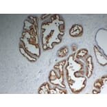 Immunohistochemistry - Anti-Prostate Specific Membrane Antigen Antibody (V0119) - Antibodies.com