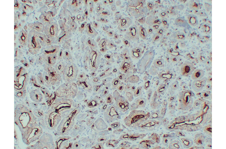 Immunohistochemistry - Anti-Prostate Specific Membrane Antigen Antibody (V0119) - Antibodies.com