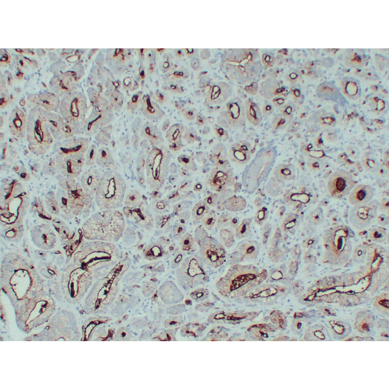 Immunohistochemistry - Anti-Prostate Specific Membrane Antigen Antibody (V0119) - Antibodies.com