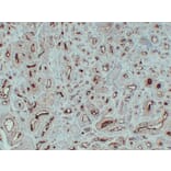 Immunohistochemistry - Anti-Prostate Specific Membrane Antigen Antibody (V0119) - Antibodies.com