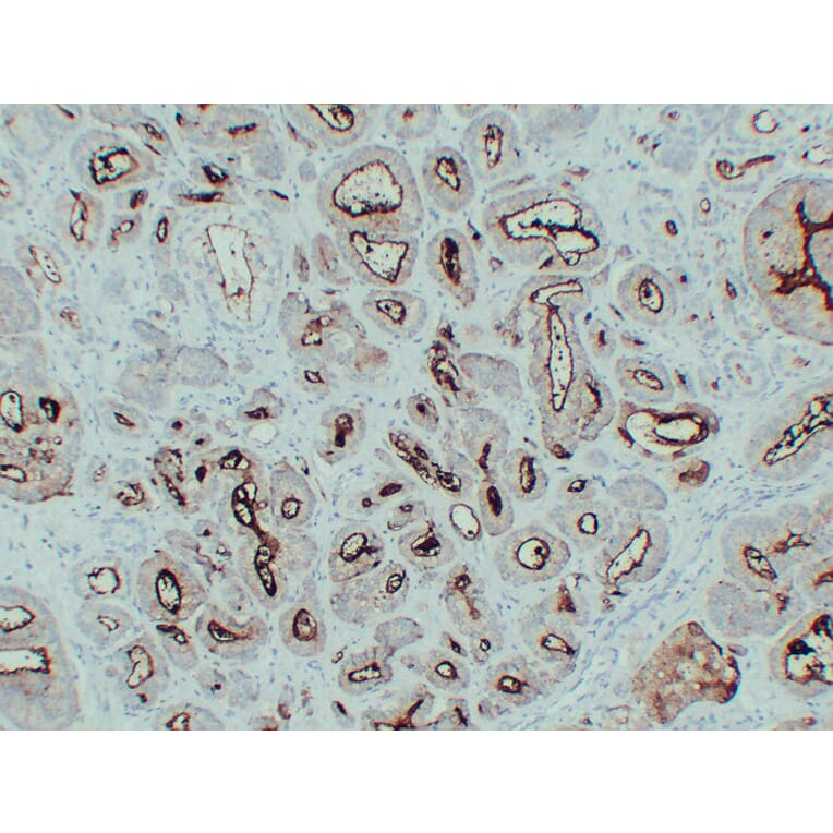 Immunohistochemistry - Anti-Prostate Specific Membrane Antigen Antibody (V0119) - Antibodies.com