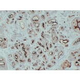 Immunohistochemistry - Anti-Prostate Specific Membrane Antigen Antibody (V0119) - Antibodies.com