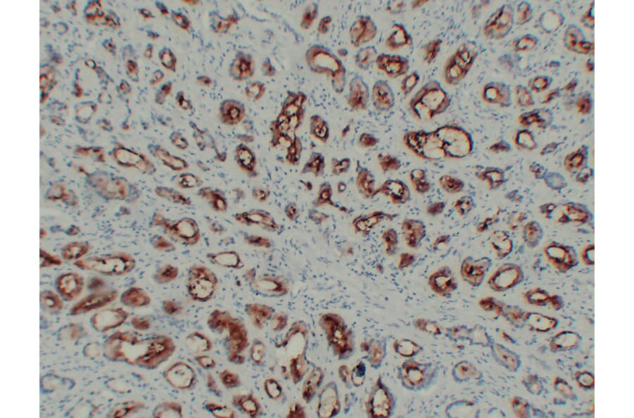 Immunohistochemistry - Anti-Prostate Specific Membrane Antigen Antibody (V0119) - Antibodies.com