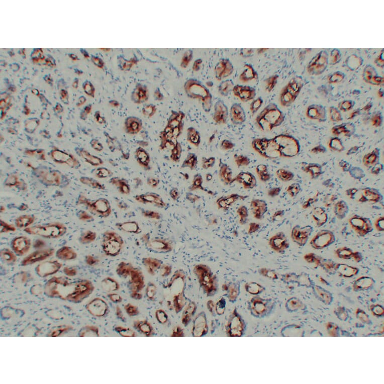Immunohistochemistry - Anti-Prostate Specific Membrane Antigen Antibody (V0119) - Antibodies.com
