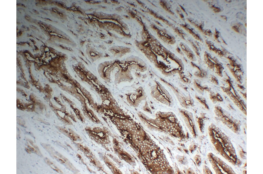Immunohistochemistry - Anti-Prostate Specific Membrane Antigen Antibody (V0119) - Antibodies.com