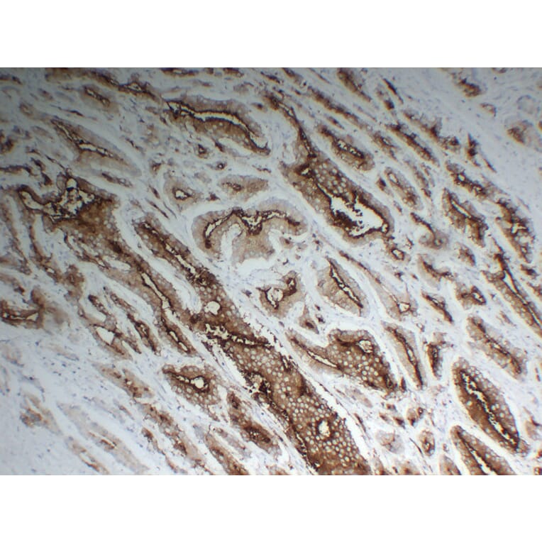 Immunohistochemistry - Anti-Prostate Specific Membrane Antigen Antibody (V0119) - Antibodies.com