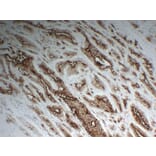 Immunohistochemistry - Anti-Prostate Specific Membrane Antigen Antibody (V0119) - Antibodies.com
