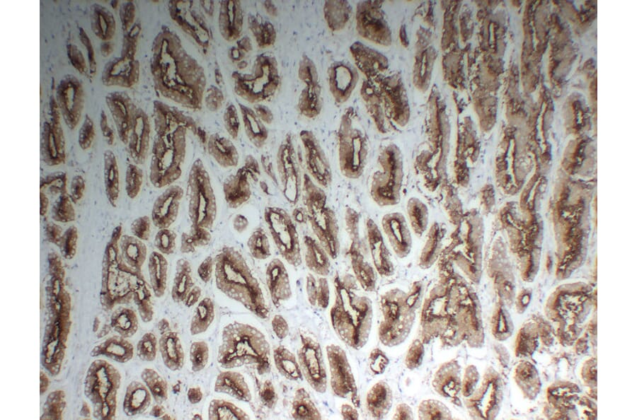 Immunohistochemistry - Anti-Prostate Specific Membrane Antigen Antibody (V0119) - Antibodies.com