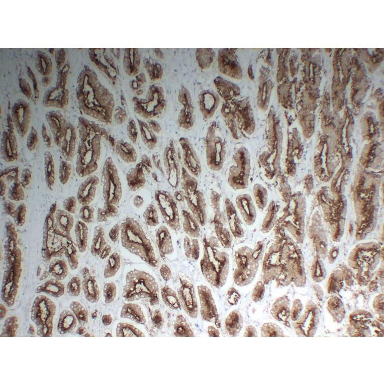 Immunohistochemistry - Anti-Prostate Specific Membrane Antigen Antibody (V0119) - Antibodies.com