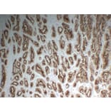 Immunohistochemistry - Anti-Prostate Specific Membrane Antigen Antibody (V0119) - Antibodies.com