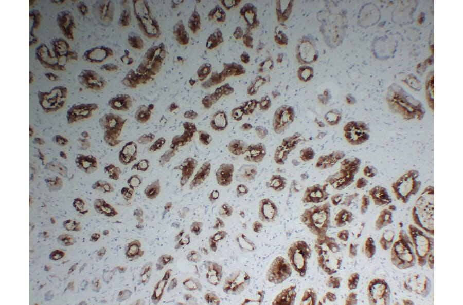 Immunohistochemistry - Anti-Prostate Specific Membrane Antigen Antibody (V0119) - Antibodies.com