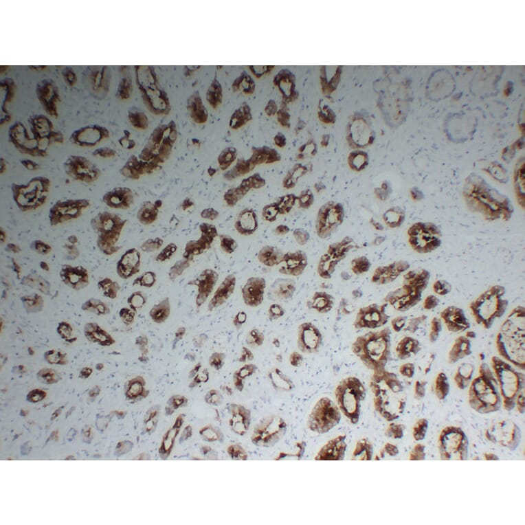 Immunohistochemistry - Anti-Prostate Specific Membrane Antigen Antibody (V0119) - Antibodies.com