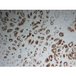 Immunohistochemistry - Anti-Prostate Specific Membrane Antigen Antibody (V0119) - Antibodies.com