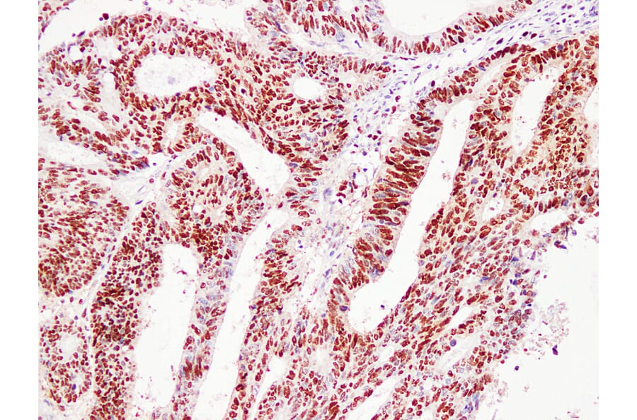 Immunohistochemistry - Anti-Proliferating Cell Nuclear Antigen Antibody (V0116) - Antibodies.com