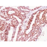 Immunohistochemistry - Anti-Proliferating Cell Nuclear Antigen Antibody (V0116) - Antibodies.com