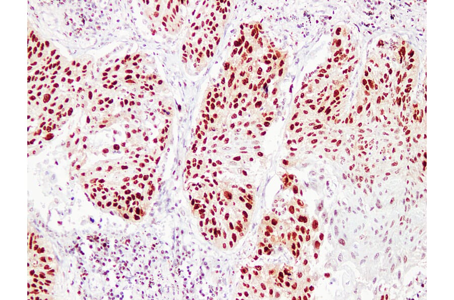 Immunohistochemistry - Anti-Proliferating Cell Nuclear Antigen Antibody (V0116) - Antibodies.com
