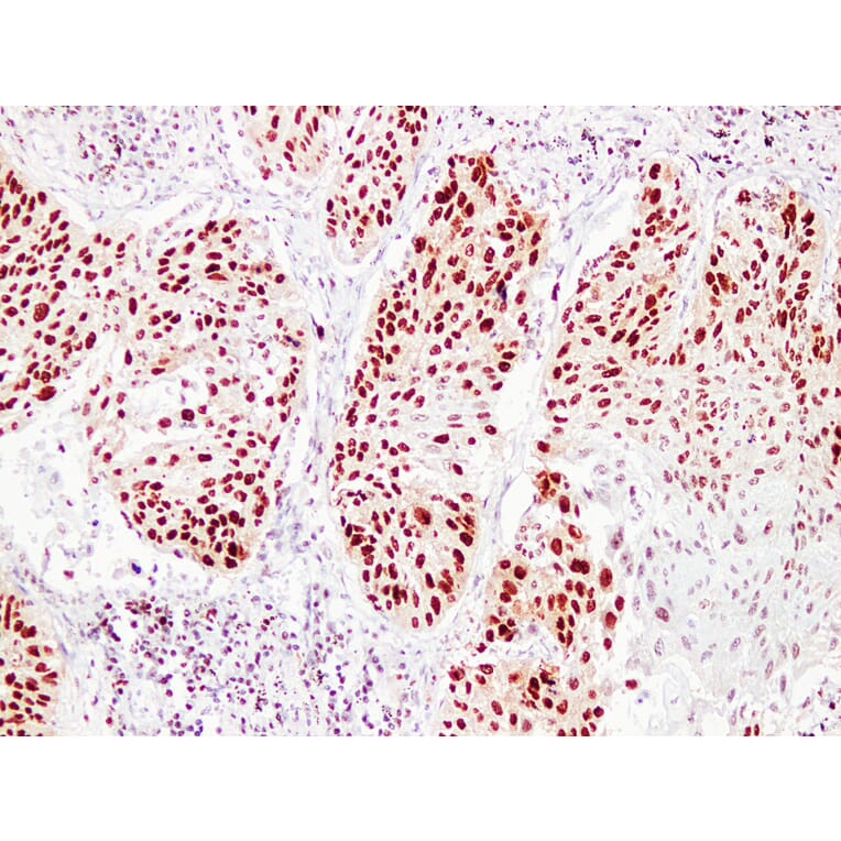 Immunohistochemistry - Anti-Proliferating Cell Nuclear Antigen Antibody (V0116) - Antibodies.com