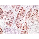 Immunohistochemistry - Anti-Proliferating Cell Nuclear Antigen Antibody (V0116) - Antibodies.com