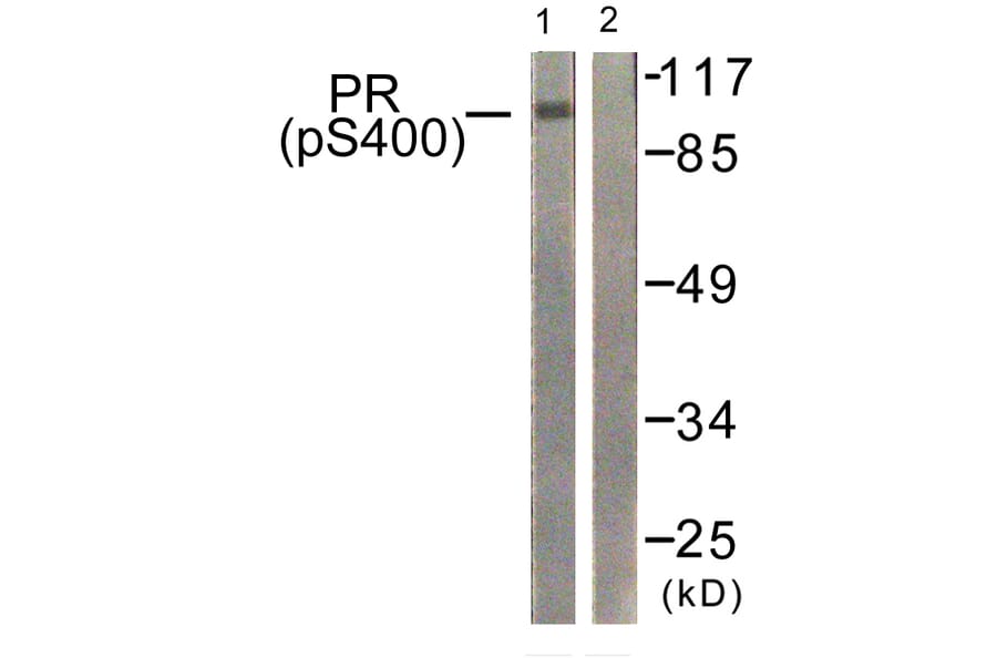 Western Blot - Anti-Progesterone Receptor (phospho Ser400) Antibody (A0559) - Antibodies.com