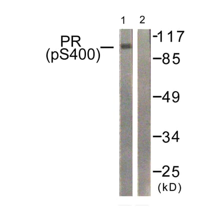 Western Blot - Anti-Progesterone Receptor (phospho Ser400) Antibody (A0559) - Antibodies.com