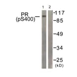 Western Blot - Anti-Progesterone Receptor (phospho Ser400) Antibody (A0559) - Antibodies.com