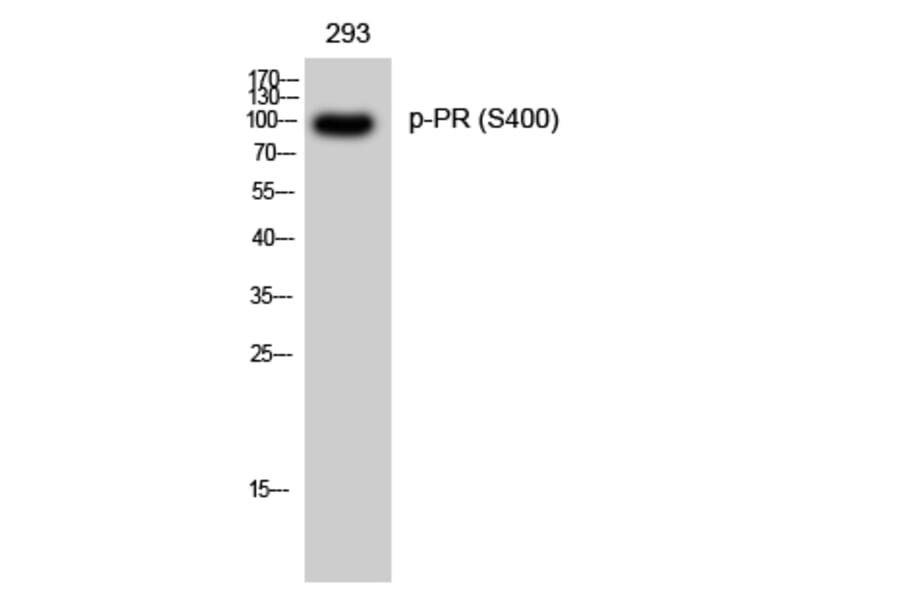 Western Blot - Anti-Progesterone Receptor (phospho Ser400) Antibody (A0559) - Antibodies.com