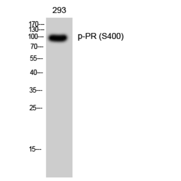 Western Blot - Anti-Progesterone Receptor (phospho Ser400) Antibody (A0559) - Antibodies.com
