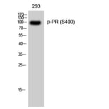Western Blot - Anti-Progesterone Receptor (phospho Ser400) Antibody (A0559) - Antibodies.com
