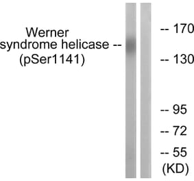 Western Blot - Anti-Werner Syndrome Helicase (phospho Ser1141) Antibody (A1246) - Antibodies.com