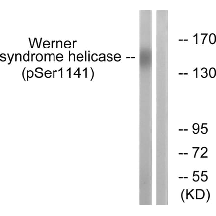Western Blot - Anti-Werner Syndrome Helicase (phospho Ser1141) Antibody (A1246) - Antibodies.com