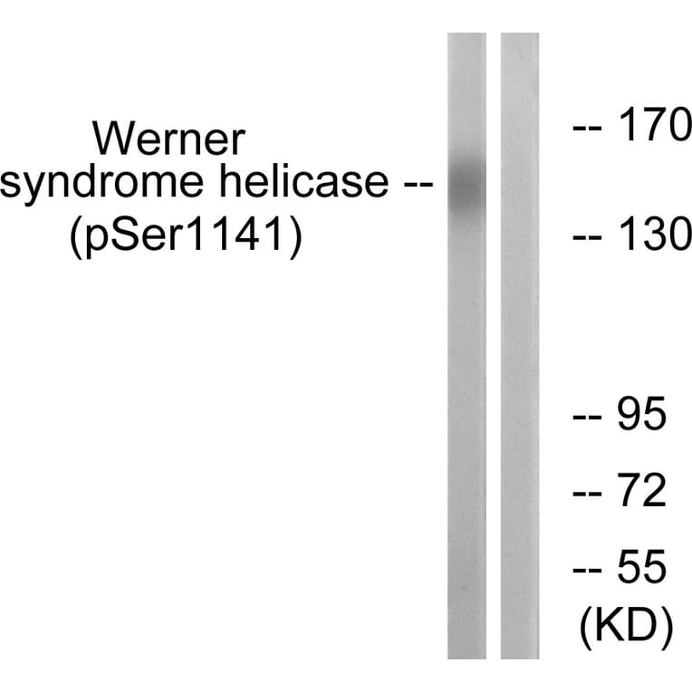 Western Blot - Anti-Werner Syndrome Helicase (phospho Ser1141) Antibody (A1246) - Antibodies.com