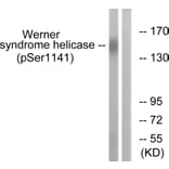 Western Blot - Anti-Werner Syndrome Helicase (phospho Ser1141) Antibody (A1246) - Antibodies.com