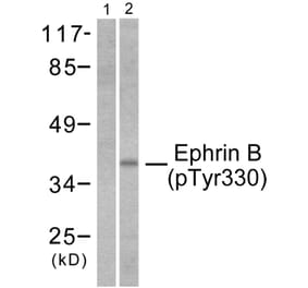 Western Blot - Anti-EFNB1 + EFNB2 (phospho Tyr330) Antibody (A0010) - Antibodies.com