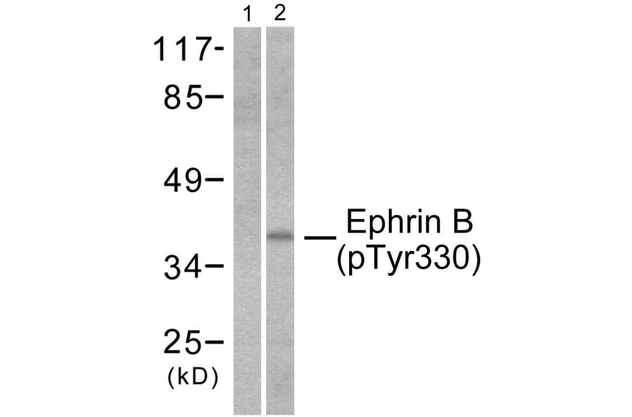 Western Blot - Anti-EFNB1 + EFNB2 (phospho Tyr330) Antibody (A0010) - Antibodies.com