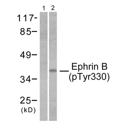 Western Blot - Anti-EFNB1 + EFNB2 (phospho Tyr330) Antibody (A0010) - Antibodies.com