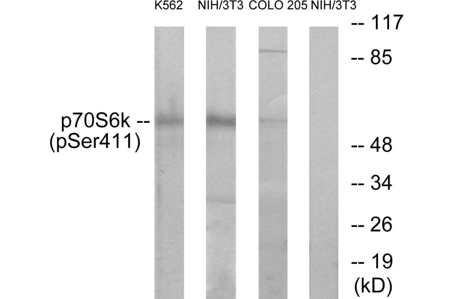Western Blot - Anti-p70 S6 Kinase (phospho Ser411) Antibody (A7188) - Antibodies.com