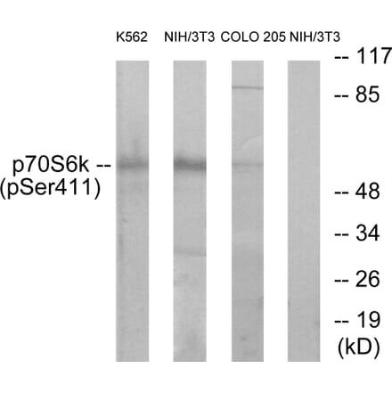 Western Blot - Anti-p70 S6 Kinase (phospho Ser411) Antibody (A7188) - Antibodies.com