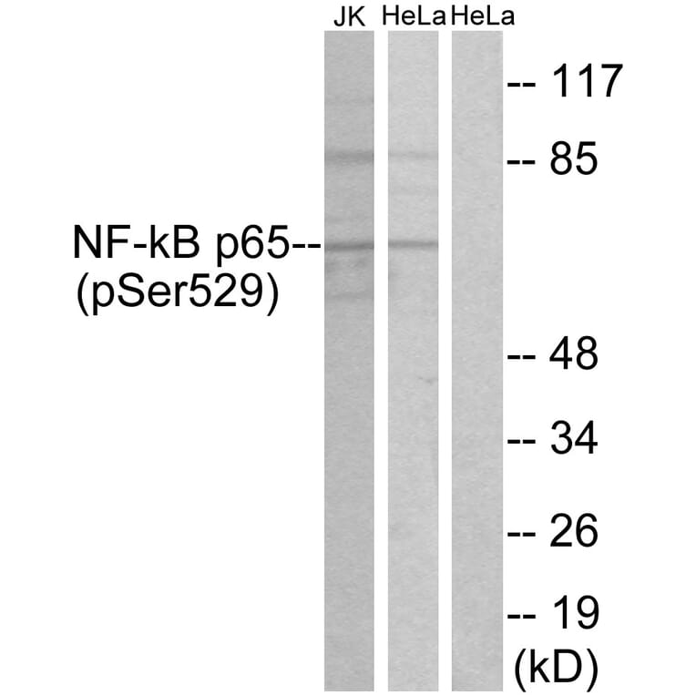 Western Blot - Anti-NF-kappaB p65 (phospho Ser529) Antibody (A7162) - Antibodies.com