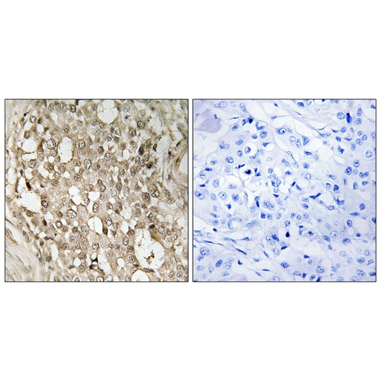 Immunohistochemistry - Anti-NF-kappaB p65 (phospho Ser529) Antibody (A7162) - Antibodies.com